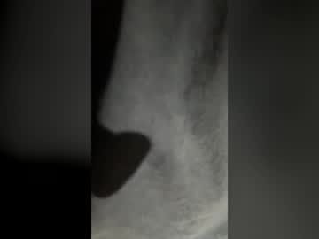 ballshot